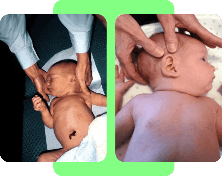 A baby being examined by doctors and nurses.